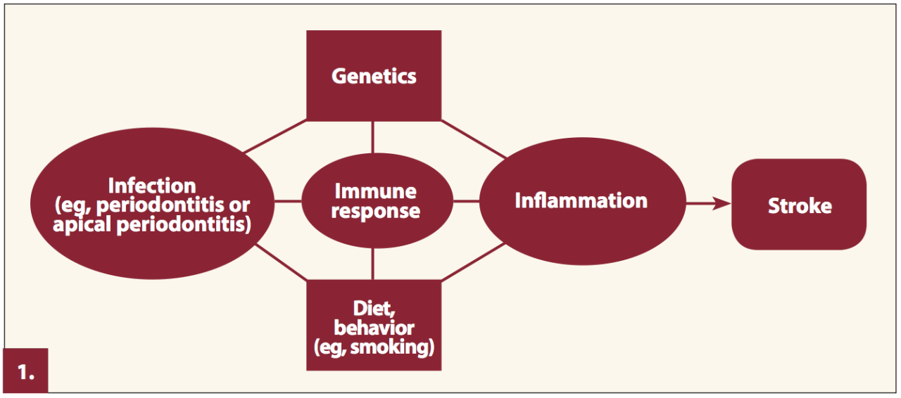 A role for oral health personnel in stroke prevention.