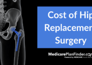 Does health insurance often cover hip replacement surgery